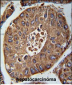 ACN9 Antibody  (N-term)